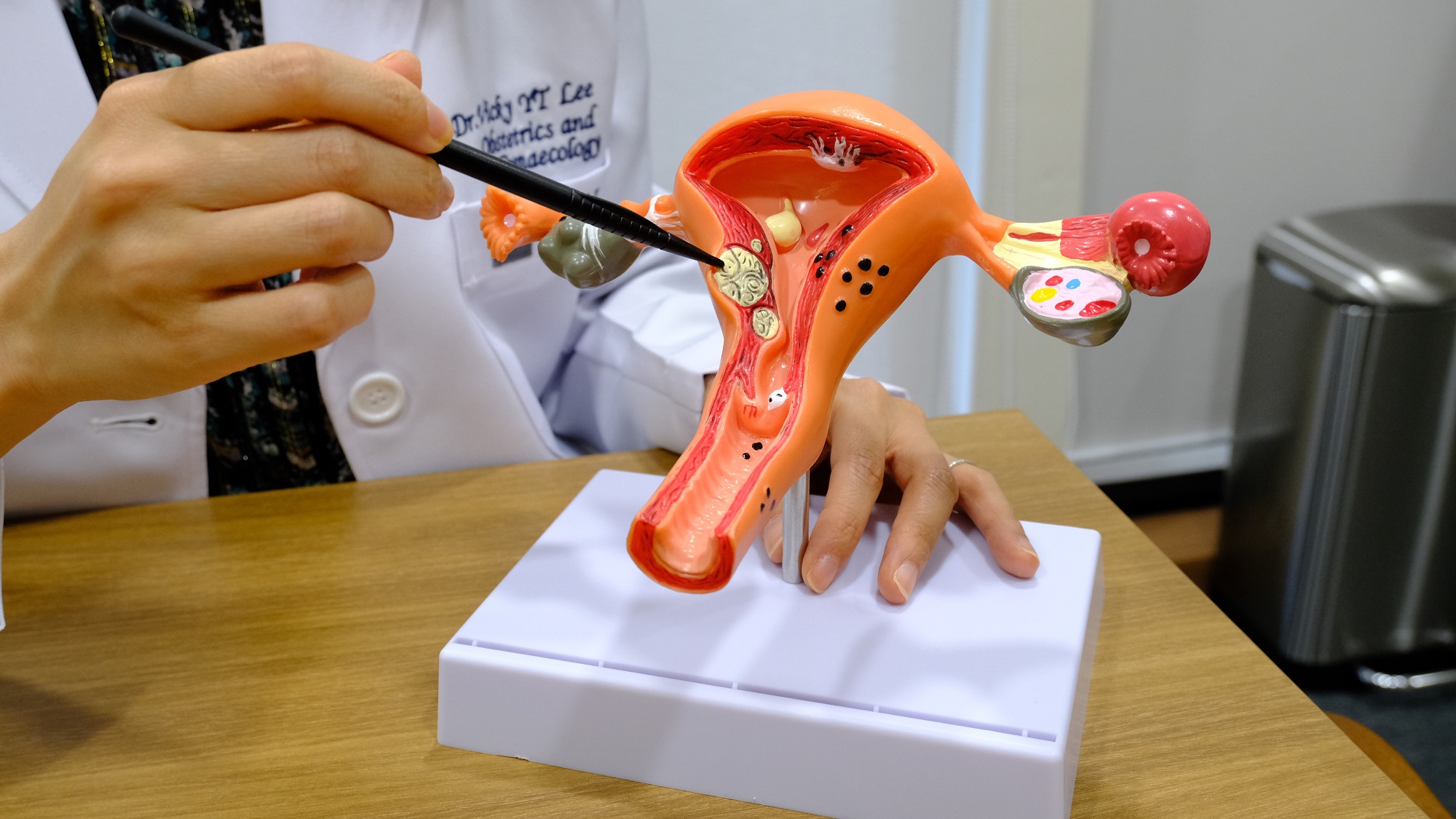 【健康】子宮肌瘤是什麼？婦產(chǎn)科醫(yī)生教你預(yù)防方法 