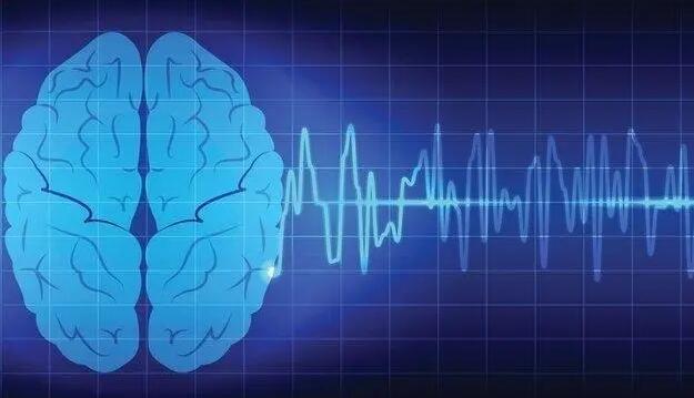 日本一公司研發(fā)出用人工智能讀取腦電波的「讀心術」