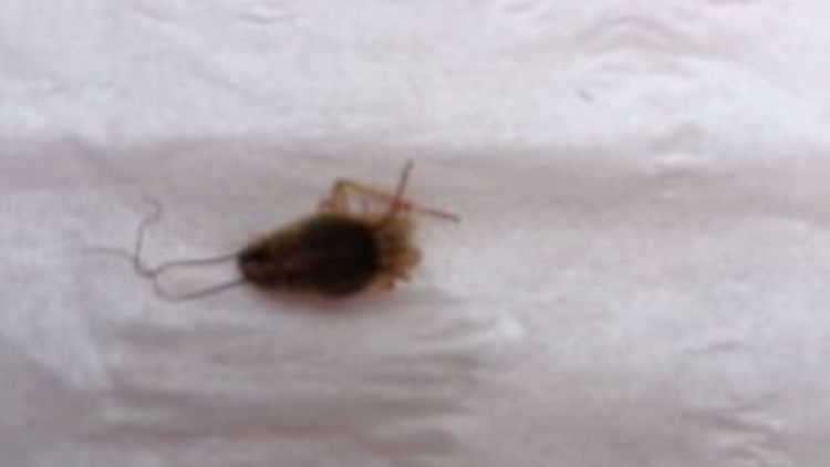 【建評】保障公共衛(wèi)生不容有「蝨」