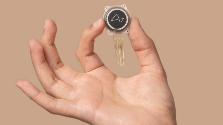 植入人類大腦晶片接線脫落 數(shù)據(jù)丟失 馬斯克Neuralink腦機(jī)接口首遇挫