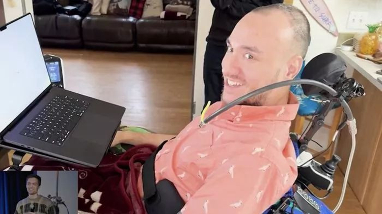 智能手機已過時？馬斯克：腦機接口技術才是未來