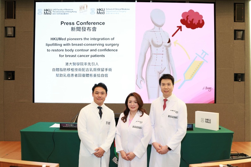 港大醫(yī)學(xué)院率先引入自體脂肪移植技術(shù)配合乳房保留手術(shù) 助乳癌患者重拾自信 